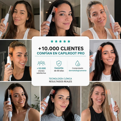 CapilRoot Pro - Recupera tu cabello y tu confianza en casa, sin químicos ni pastillas